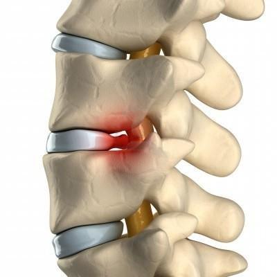 Рука болит левое боль в шее в спине