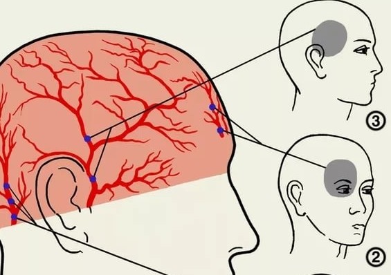 от чего болит голова когда закрываешь глаза
