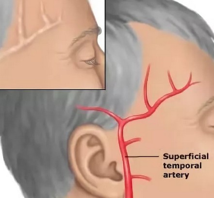 Болит голова в правом виске и затылке