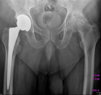 болит пах и спина