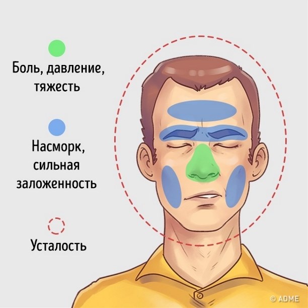 Безумно болит голова почему