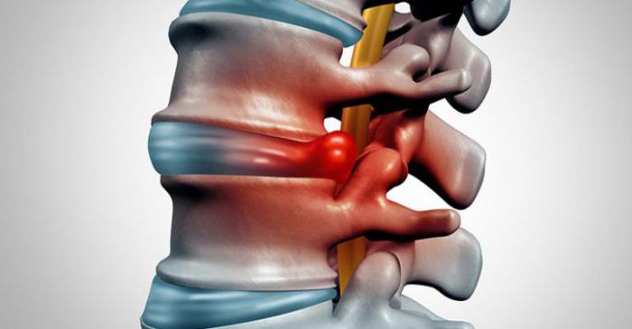 просыпаюсь от того что болит спина