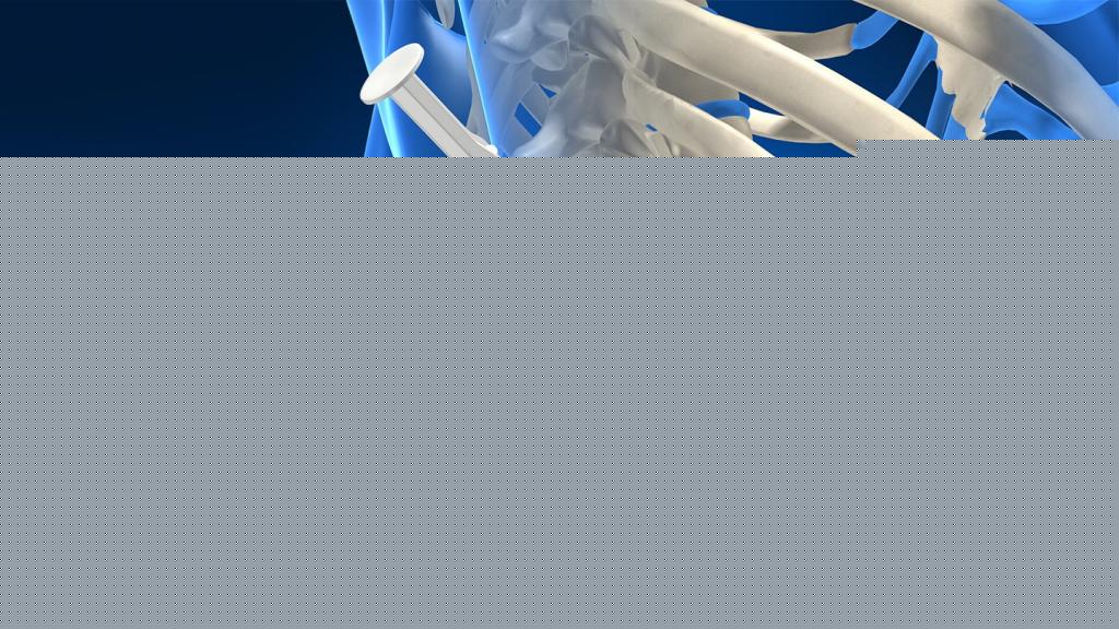 болит пояснице слева ногу