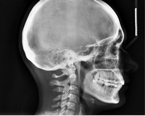 Болит голова когда встаешь и идешь