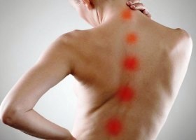 Боль, связанная с патологиями позвоночного столба Боль, связанная с патологиями позвоночного столба