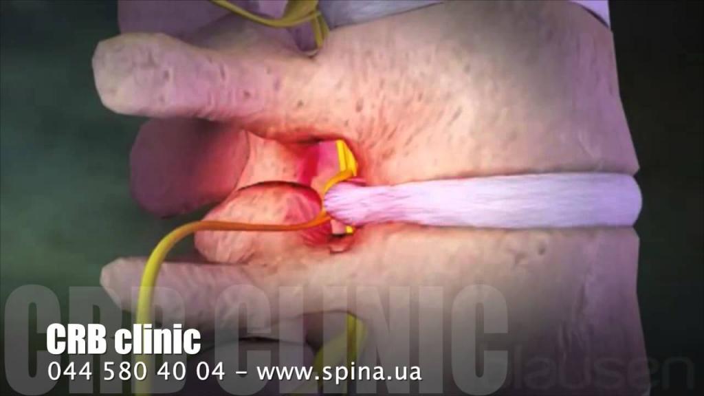 Болит спина внизу делать