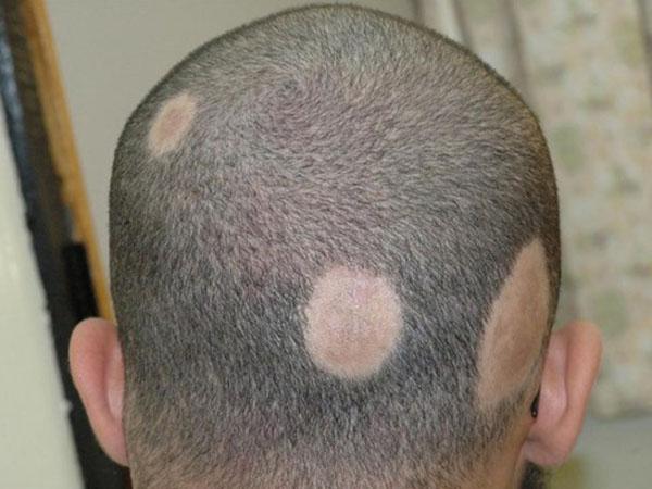 На голове появились красные пятна и болят