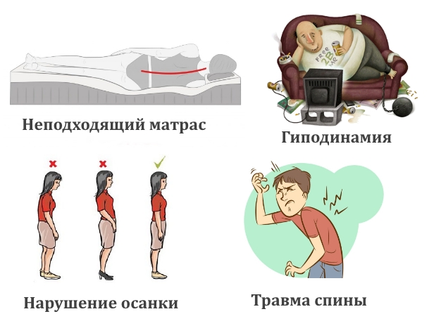 Бытовые причины боли в спине Бытовые причины боли в спине