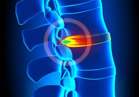 болят лопатки шея и голова