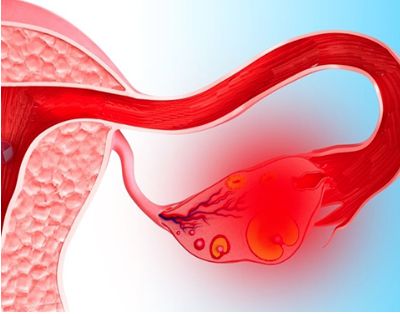 почему болит спина после месячных как при месячных