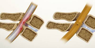 болит пах и спина