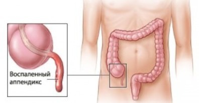 Крутит желудок и болит голова