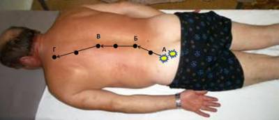 Болевые точки спины Болевые точки спины