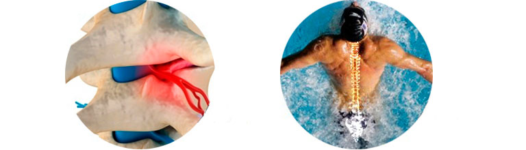 в бассейне болит спина