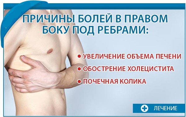 Причины болей в ребрах справа