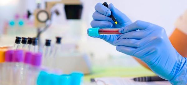 Диагностика при болях в ребрах