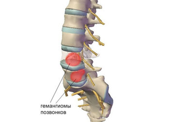 Не могу долго стоять на ногах болит спина