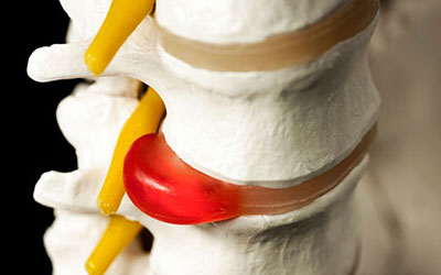 Рука болит левое боль в шее в спине