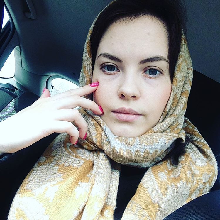 Может ли от нервов болеть голова