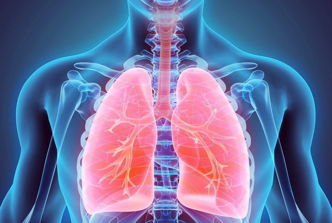 Двустороннее воспаление легких Двустороннее воспаление легких