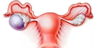 Болит спина и мышцы паха