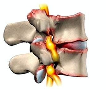 Рука болит левое боль в шее в спине