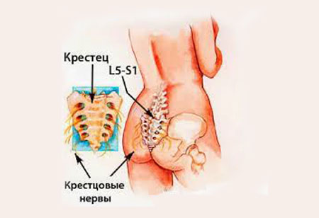 Причины боли в крестце у женщин