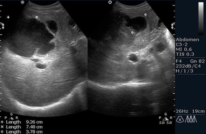 Снимок диагностического исследования при помощи ультразвука