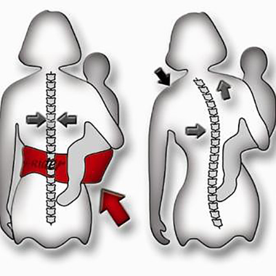Болит спина после слинга