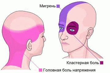 Голова болит второй день помогает только таблетка