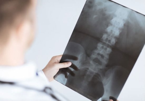 Рентген позвоночника